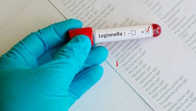 Is Legionella check a legal requirement in UK